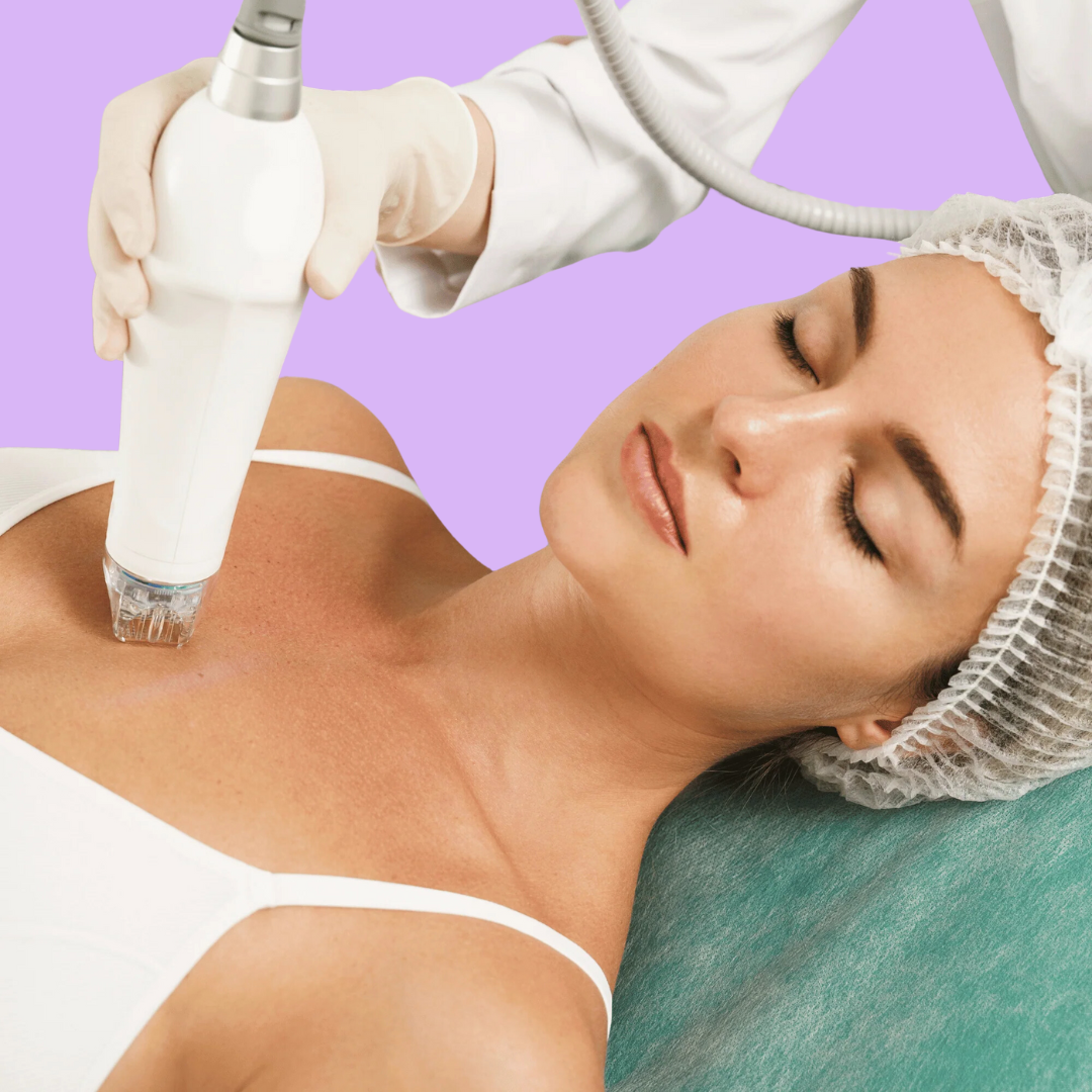 Micro-needling Decolletage