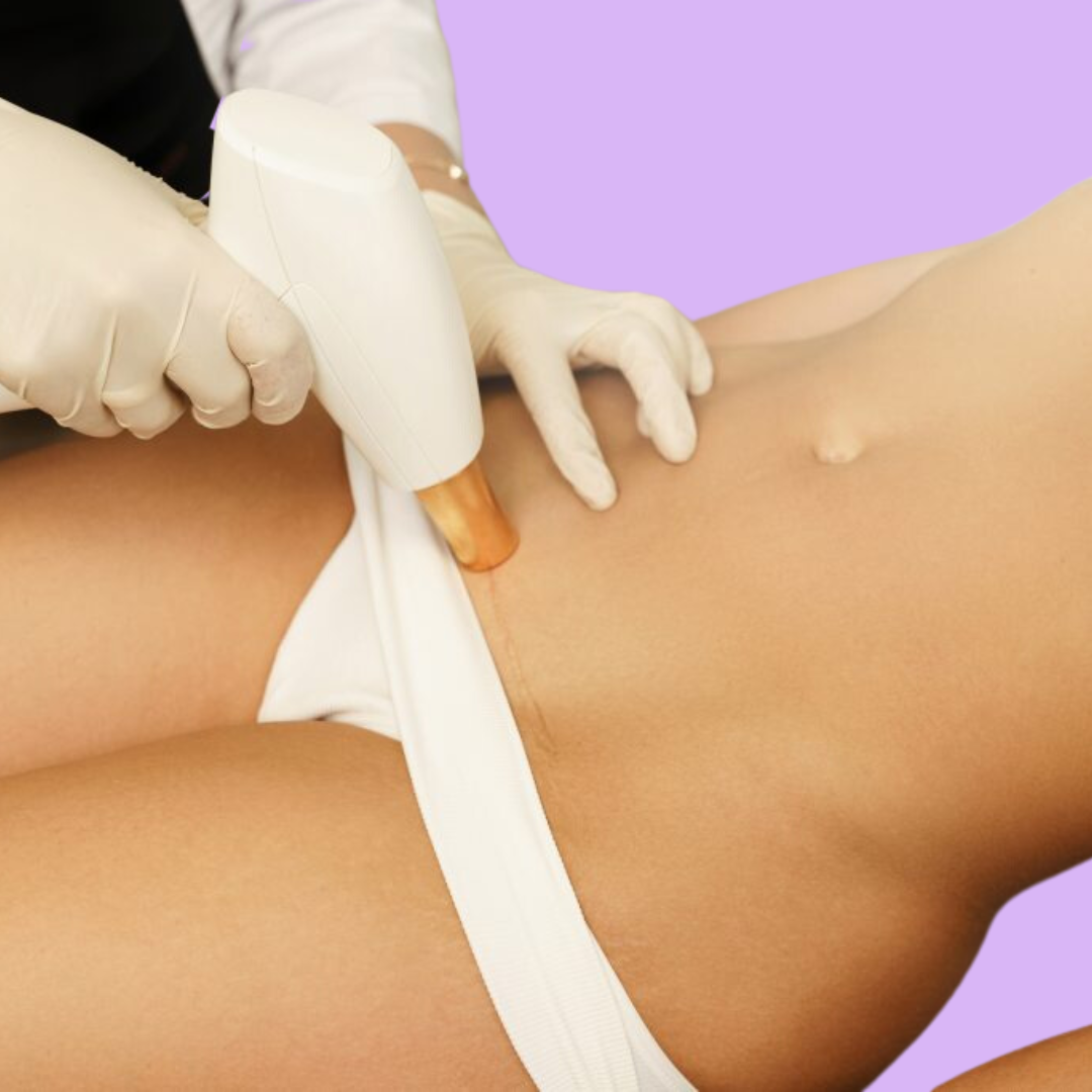 Laser hair Removal / IPL hair removal Individual Area selection - Please Select the Specific Service