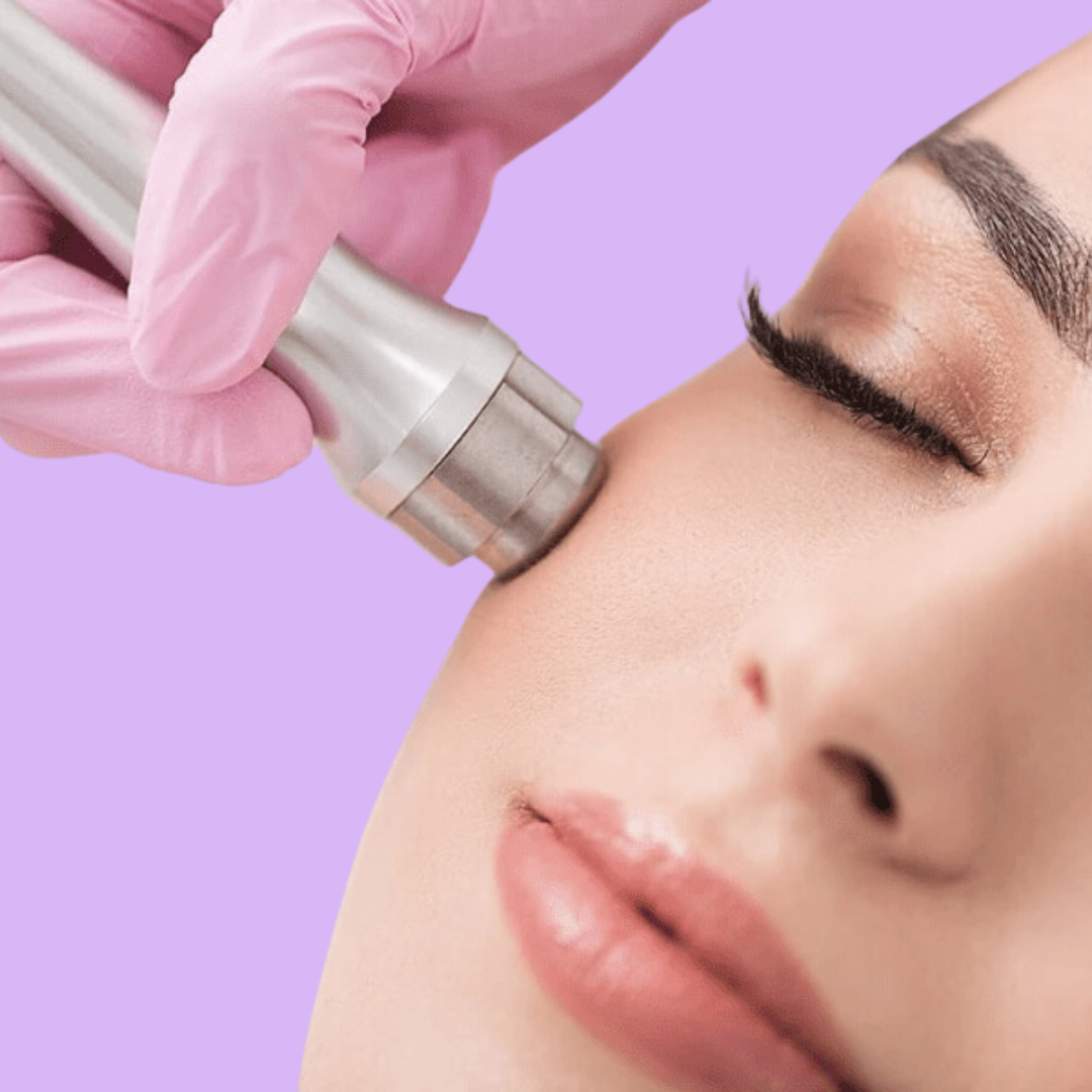 Microdermabrasion