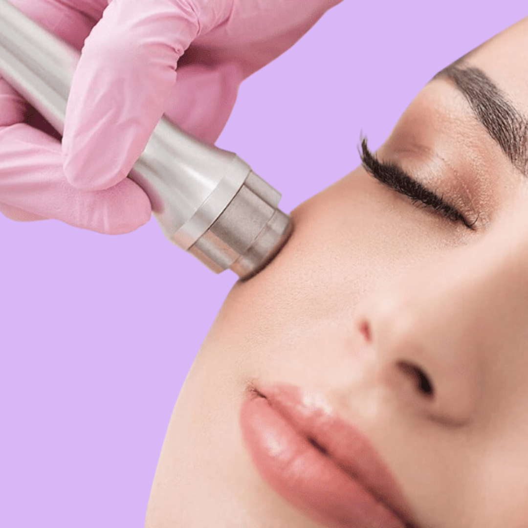 Microdermabrasion - Please Select the Specific Service – D and T Beauty zone