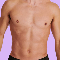 Chest + Stomach Package - Laser hair Removal